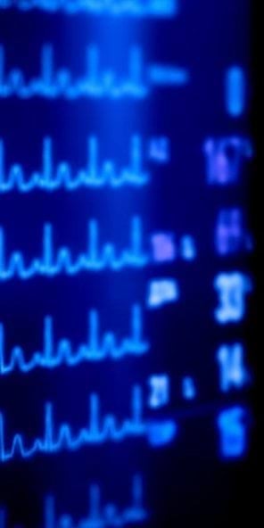 Computer screen with data rendered as a chart